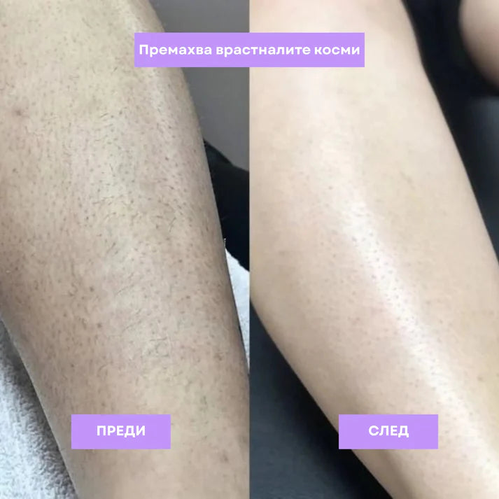 Glam™ Масло Против Окосмяване