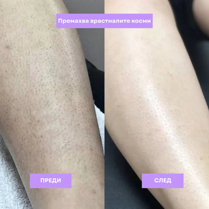 Glam™ Масло Против Окосмяване